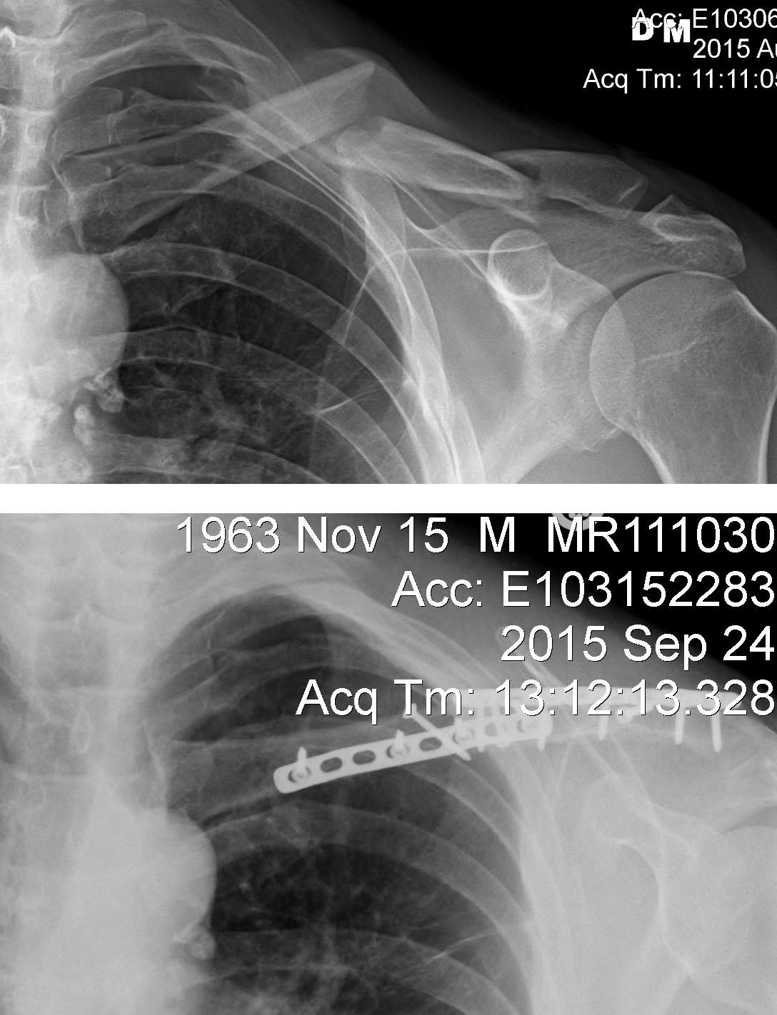 X-Rays